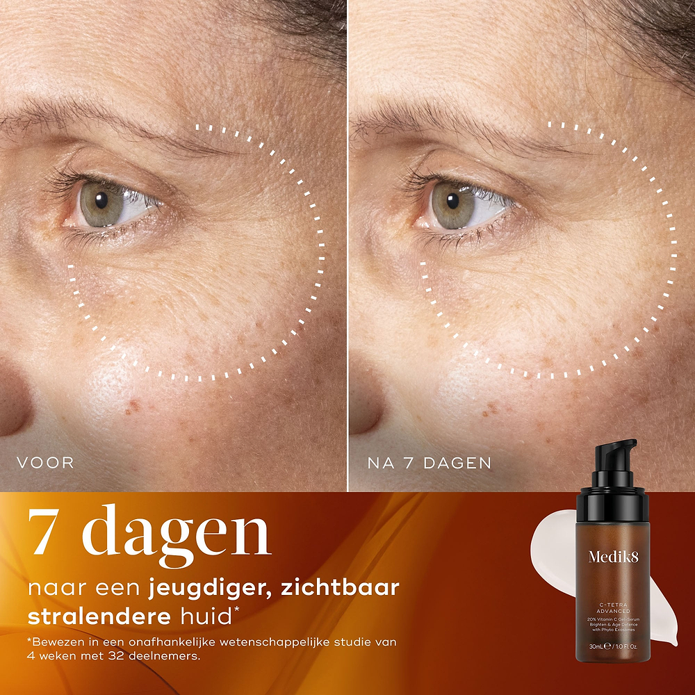 Voor- en na-vergelijking van de huid van een deelnemer over 7 dagen, waarbij zichtbaar helderdere huid met verbeterde uitstraling en een egalere teint wordt getoond.
Voor- en na-close-up van de huid van een deelnemer over 7 dagen, die een zichtbaar gladdere huidtextuur en verfijnde uitstraling laat zien.