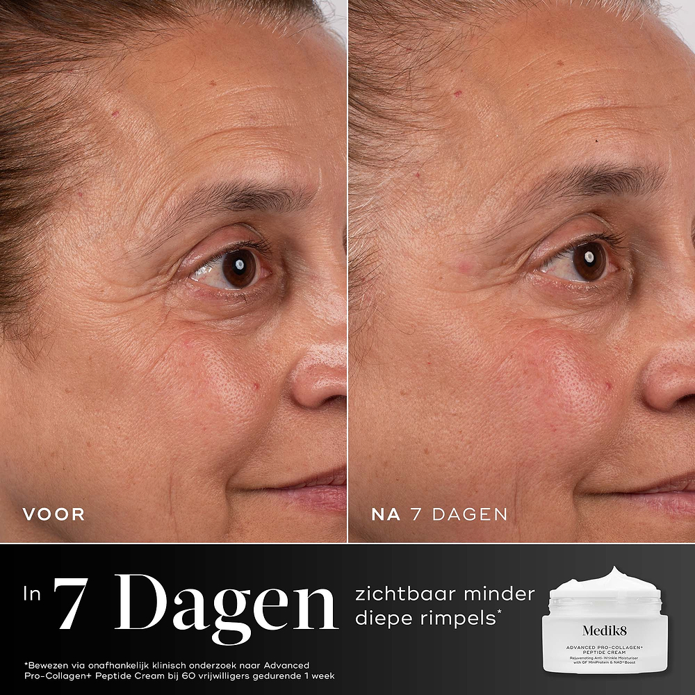 Voor- en na-vergelijking van het ooggebied van een deelnemer over 7 dagen, weergegeven naast de pot van Medik8 Advanced Pro-Collagen+ Peptide Cream. Tekst benadrukt dat het product bewezen is om de diepte van rimpels zichtbaar te verminderen binnen 7 dagen.