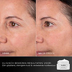 Voor- en na-vergelijking van het gezicht van een deelnemer over 28 dagen, weergegeven naast de pot van Medik8 Advanced Pro-Collagen+ Peptide Cream. Tekst benadrukt klinisch bewezen resultaten op het gebied van gladheid, stevigheid en huidtextuur.