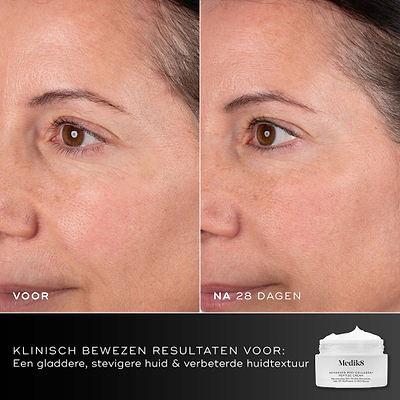 Voor- en na-vergelijking van het gezicht van een deelnemer over 28 dagen, weergegeven naast de pot van Medik8 Advanced Pro-Collagen+ Peptide Cream. Tekst benadrukt klinisch bewezen resultaten op het gebied van gladheid, stevigheid en huidtextuur.