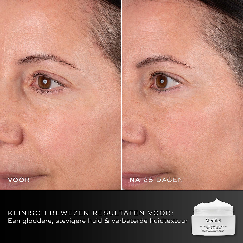 Voor- en na-vergelijking van het gezicht van een deelnemer over 28 dagen, weergegeven naast de pot van Medik8 Advanced Pro-Collagen+ Peptide Cream. Tekst benadrukt klinisch bewezen resultaten op het gebied van gladheid, stevigheid en huidtextuur.