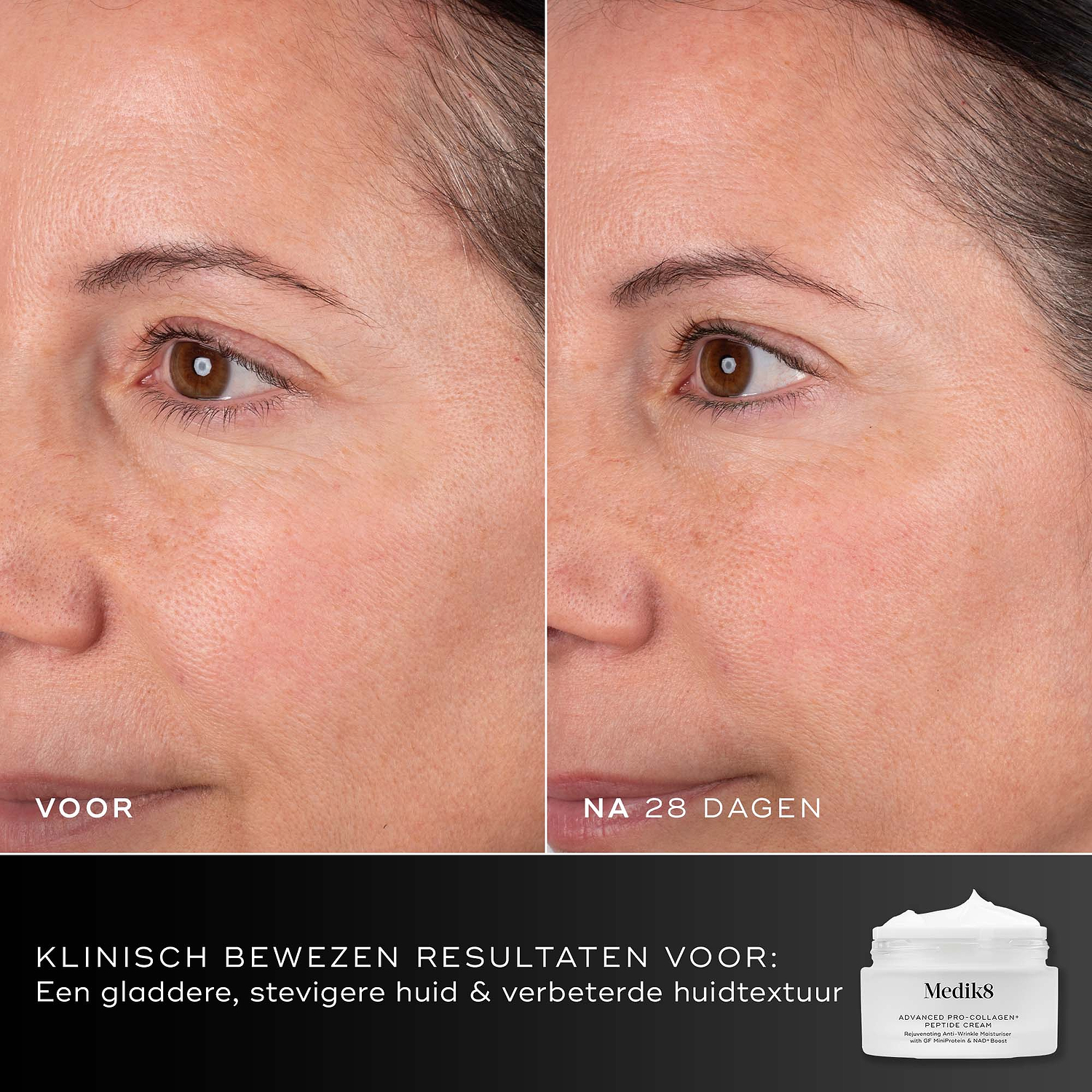 Voor- en na-vergelijking van het gezicht van een deelnemer over 28 dagen, weergegeven naast de pot van Medik8 Advanced Pro-Collagen+ Peptide Cream. Tekst benadrukt klinisch bewezen resultaten op het gebied van gladheid, stevigheid en huidtextuur.