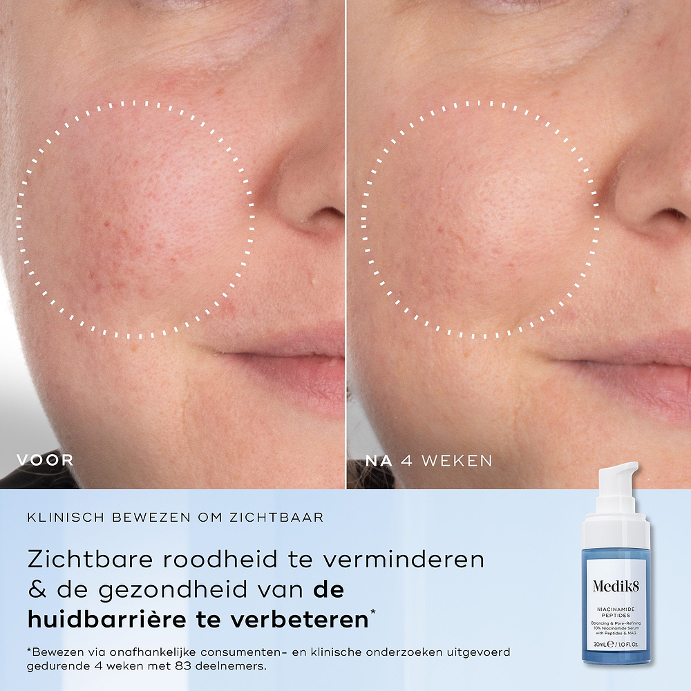Niacinamide Peptides™