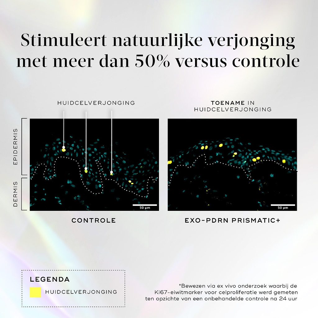 Een infographic op een licht holografische achtergrond met de titel “Verhoogt natuurlijke vernieuwing met meer dan 50% ten opzichte van de controle”. Twee microscopische dwarsdoorsneden van de huid vergelijken een “Controle” met “Exo-PDRN Prismatic+”.