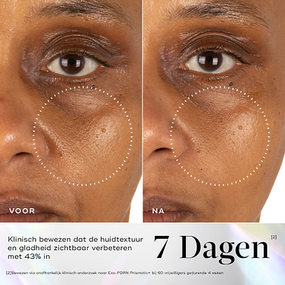 Voor- en nafoto’s van de huid rond de ogen met verbeterde huidvitaliteit en luminositeit na 7 dagen gebruik van Medik8 Exo-PDRN Prismatic+.