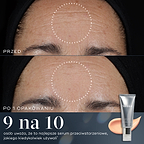 Porównanie zdjęcia czoła przed i po zastosowaniu produktu pokazuje widoczną poprawę w zakresie drobnych zmarszczek i bruzd już po zużyciu jednej tubki preparatu Crystal Retinal. Zgodnie z informacją zawartą w tekście 9 na 10 osób zgadza się, że jest to najlepsze serum przeciwstarzeniowe, jakiego kiedykolwiek używały.