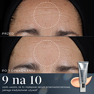 Porównanie zdjęcia czoła przed i po zastosowaniu produktu pokazuje widoczną poprawę w zakresie drobnych zmarszczek i bruzd już po zużyciu jednej tubki preparatu Crystal Retinal. Zgodnie z informacją zawartą w tekście 9 na 10 osób zgadza się, że jest to najlepsze serum przeciwstarzeniowe, jakiego kiedykolwiek używały.