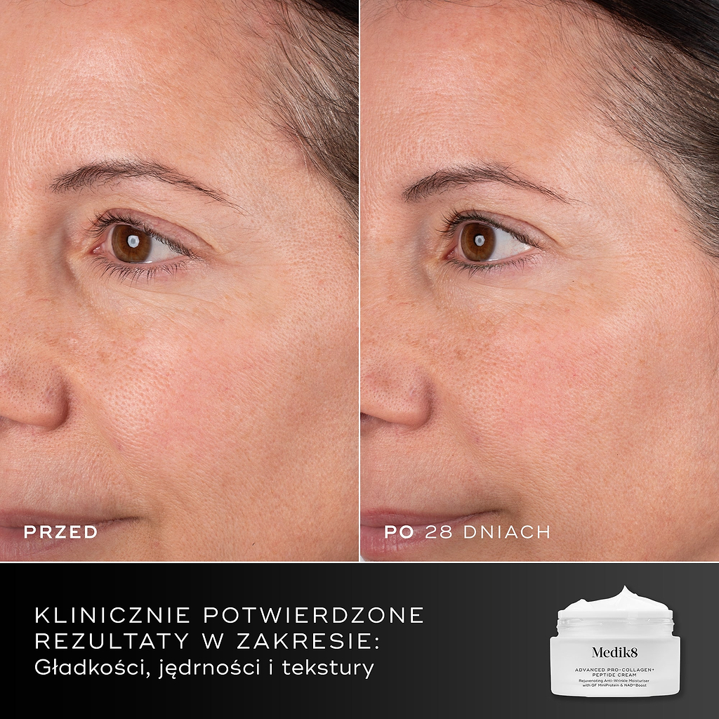 28 dni – Porównanie twarzy uczestniczki przed i po kuracji trwającej 28 dni, przedstawione obok opakowania kremu Medik8 Advanced Pro-Collagen+ Peptide Cream. Tekst podkreśla potwierdzone klinicznie efekty w zakresie gładkości, jędrności i struktury skóry.
