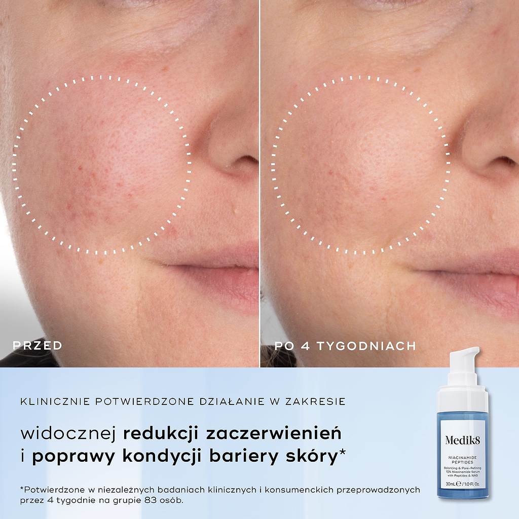 Podzielone zdjęcie przedstawiające zbliżenie struktury skóry z podpisami „Przed” i „Po 4 tygodniach”, podkreślające poprawę stanu skóry. Tekst po lewej stronie wymienia korzyści: zmniejszenie niedoskonałości, poprawa struktury skóry, zmniejszenie rozmiaru porów oraz złagodzenie widocznych zaczerwienień.
