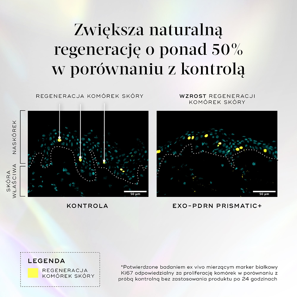 Ilustracja zatytułowana „Zwiększenie naturalnego odmładzania o ponad 50% w porównaniu z grupą kontrolną”, przedstawiająca porównanie dwóch obrazów skóry właściwej i naskórka, wskazująca na proces odmładzania komórek skóry oraz jego wzmocnienie dzięki preparatowi Exo-PDRN Prismatic+. 

*Potwierdzono w badaniu ex vivo, w którym zmierzono poziom markera białkowego Ki67, wskazującego na proliferację komórek, w porównaniu z grupą kontrolną bez leczenia po upływie 24 godzin