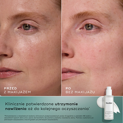Zdjęcia twarzy kobiety przed i po zabiegu, umieszczone obok siebie, pokazujące poprawę nawilżenia i przejrzystości skóry, wraz z informacją o produkcie i tekstem potwierdzającym jego działanie.
