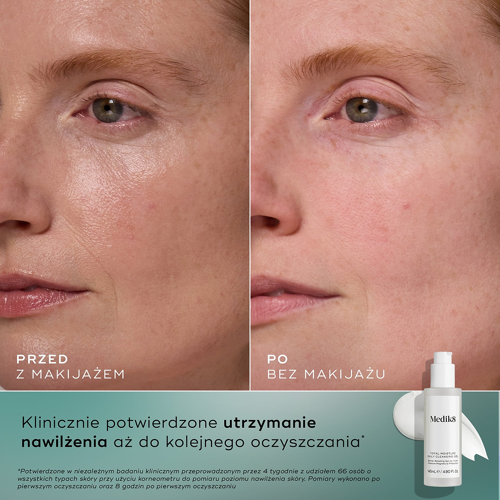 Zdjęcia twarzy kobiety przed i po zabiegu, umieszczone obok siebie, pokazujące poprawę nawilżenia i przejrzystości skóry, wraz z informacją o produkcie i tekstem potwierdzającym jego działanie.