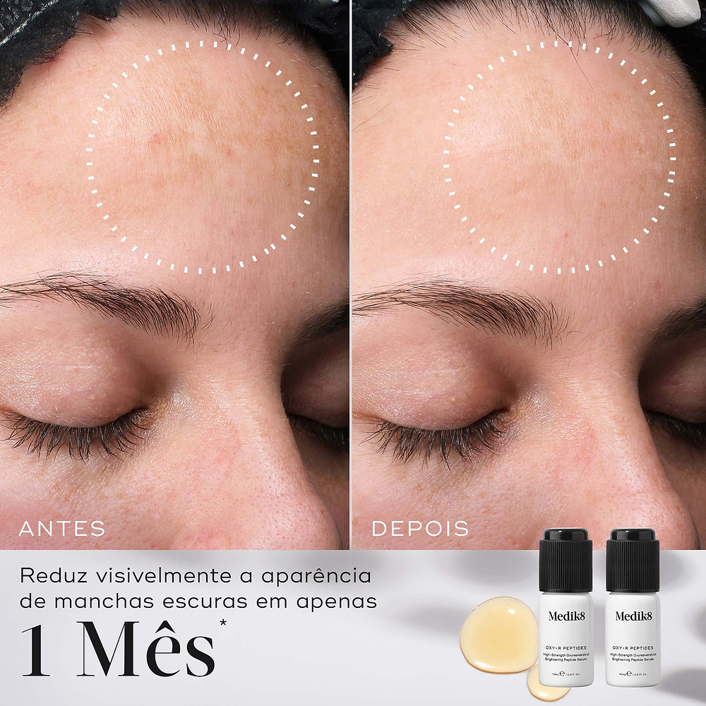 Comparação de antes e depois de uma testa ao longo de 1 mês, com um círculo pontilhado destacando uma redução visível das manchas escuras. Abaixo, os dois frascos de Oxy-R Peptides são mostrados com o texto afirmando que reduz visivelmente a aparência de manchas escuras em apenas 1 mês.