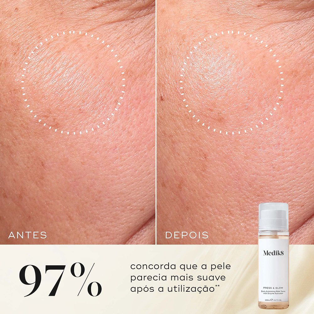 Comparação de antes e depois de uma bochecha mostrando uma textura visivelmente mais suave, destacada por um círculo pontilhado. Abaixo, ao lado de um frasco de Press & Glow, o texto afirma que 97% concorda que a pele parecia mais suave após a utilização.