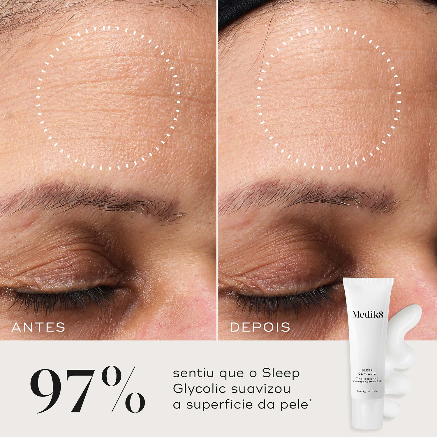 Comparação de antes e depois de uma testa, com um círculo pontilhado destacando uma textura de pele visivelmente mais suave. Abaixo, ao lado de um tubo de Sleep Glycolic e uma amostra de creme, o texto afirma que 97% sentiu que o Sleep Glycolic suavizou a superfície da pele.