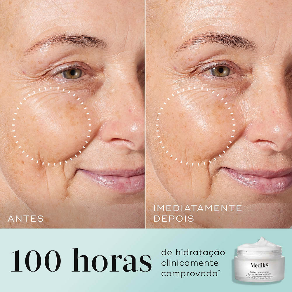Um close-up de antes e depois da bochecha de uma mulher, rotulado "ANTES" e "IMEDIATAMENTE DEPOIS". Um círculo pontilhado destaca uma pele visivelmente mais suave e preenchida. Abaixo, o frasco do Medik8 Total Moisture Daily Facial Cream é mostrado com o texto afirmando 100 horas de hidratação clinicamente comprovada.