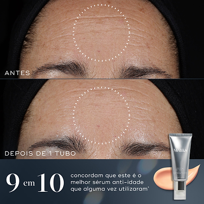 Crystal Retinal®