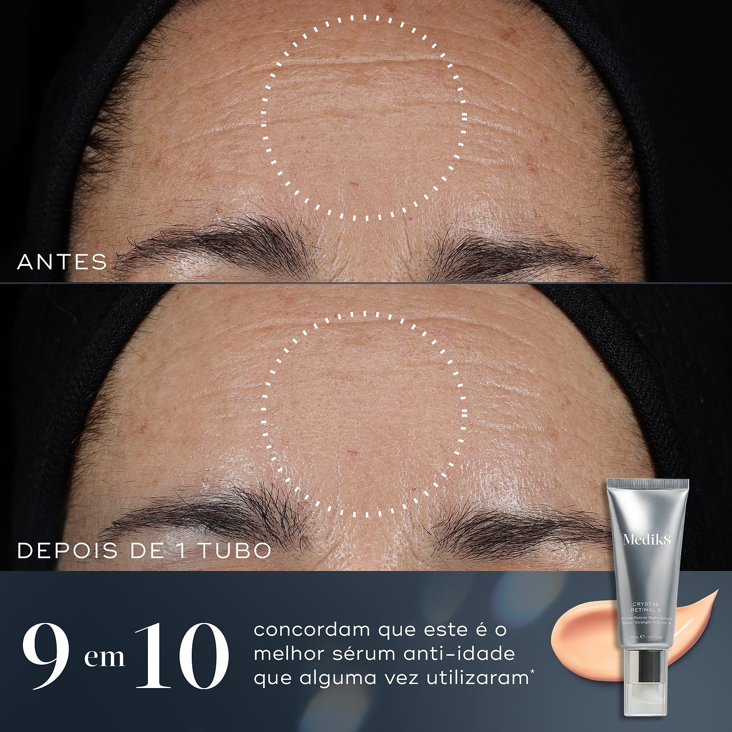Crystal Retinal®