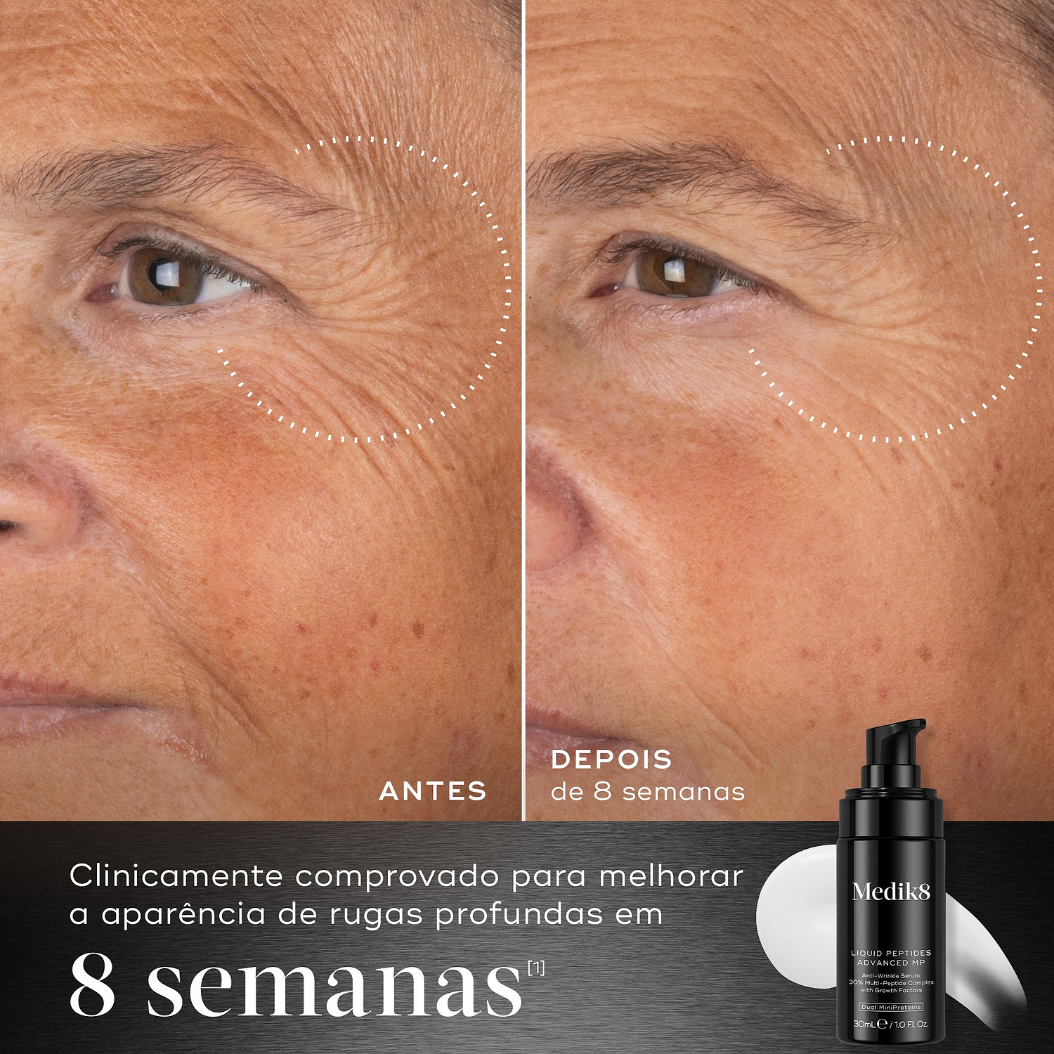 Comparação antes e depois das rugas profundas ao redor dos olhos de uma participante ao longo de 8 semanas, ao lado de um frasco de Medik8 Liquid Peptides Advanced MP. O texto em português afirma que é clinicamente comprovado para melhorar a aparência de rugas profundas em 8 semanas.