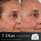 Um close-up de comparação de antes e depois da área dos olhos de uma mulher ao longo de 7 dias é mostrado contra um fundo cinza escuro dividido. Os rótulos "ANTES" e "DEPOIS DE 7 DIAS" estão na parte inferior. Um gráfico abaixo mostra um frasco de creme Medik8 e um texto branco grande informando 7 Dias para reduzir visivelmente a profundidade das rugas. Uma isenção de responsabilidade detalha o estudo clínico independente.