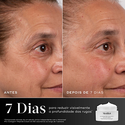 Um close-up de comparação de antes e depois da área dos olhos de uma mulher ao longo de 7 dias é mostrado contra um fundo cinza escuro dividido. Os rótulos "ANTES" e "DEPOIS DE 7 DIAS" estão na parte inferior. Um gráfico abaixo mostra um frasco de creme Medik8 e um texto branco grande informando 7 Dias para reduzir visivelmente a profundidade das rugas. Uma isenção de responsabilidade detalha o estudo clínico independente.