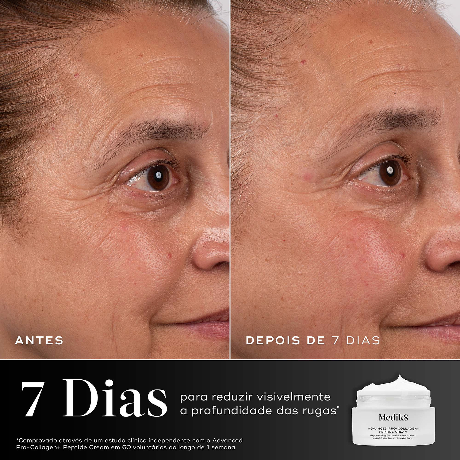 Um close-up de comparação de antes e depois da área dos olhos de uma mulher ao longo de 7 dias é mostrado contra um fundo cinza escuro dividido. Os rótulos "ANTES" e "DEPOIS DE 7 DIAS" estão na parte inferior. Um gráfico abaixo mostra um frasco de creme Medik8 e um texto branco grande informando 7 Dias para reduzir visivelmente a profundidade das rugas. Uma isenção de responsabilidade detalha o estudo clínico independente.