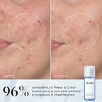 Comparação de antes e depois de uma bochecha mostrando uma textura visivelmente mais suave, destacada por um círculo pontilhado. Abaixo, ao lado de um frasco de Press & Glow, o texto afirma que 97% concorda que a pele parecia mais suave após a utilização.