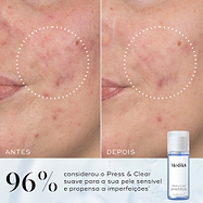 Comparação de antes e depois de uma bochecha mostrando uma textura visivelmente mais suave, destacada por um círculo pontilhado. Abaixo, ao lado de um frasco de Press & Glow, o texto afirma que 97% concorda que a pele parecia mais suave após a utilização.