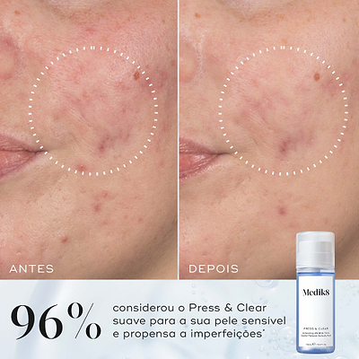 Comparação de antes e depois de uma bochecha mostrando uma textura visivelmente mais suave, destacada por um círculo pontilhado. Abaixo, ao lado de um frasco de Press & Glow, o texto afirma que 97% concorda que a pele parecia mais suave após a utilização.
