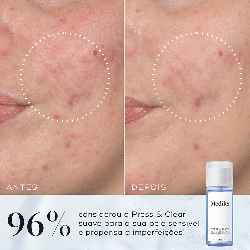 Comparação de antes e depois de uma bochecha mostrando uma textura visivelmente mais suave, destacada por um círculo pontilhado. Abaixo, ao lado de um frasco de Press & Glow, o texto afirma que 97% concorda que a pele parecia mais suave após a utilização.