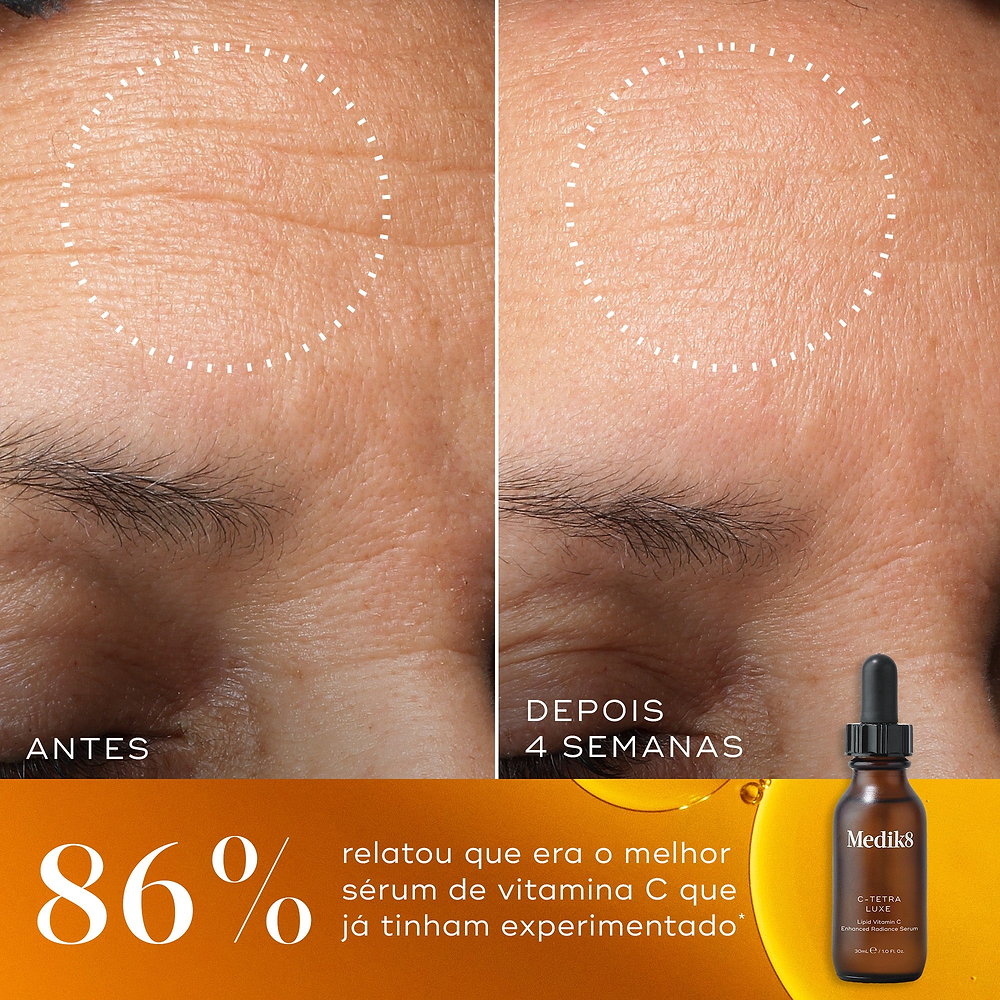 Comparação de antes e depois de rugas na testa ao longo de 4 semanas, com um círculo pontilhado destacando uma pele visivelmente mais suave. Abaixo, ao lado de um frasco de C-Tetra Luxe, o texto afirma que 86% relatou que este era o melhor sérum de vitamina C que já tinham experimentado.