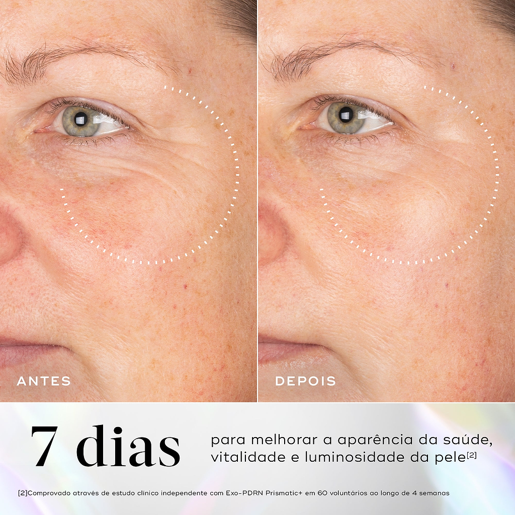 Comparação antes e depois da área dos olhos de uma participante ao longo de 7 dias. O texto em português aponta 7 dias para melhorar a aparência da saúde, vitalidade e luminosidade da pele.