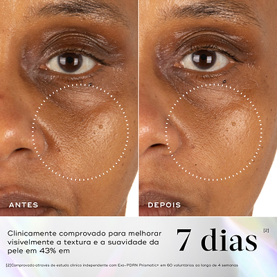 Comparação antes e depois da área sob os olhos e bochecha de uma participante ao longo de 7 dias. O texto em português destaca que é clinicamente comprovado para melhorar visivelmente a textura e a suavidade da pele em 43% em 7 dias.