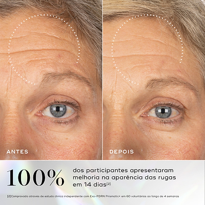 Comparação antes e depois das rugas na testa de uma participante ao longo de 14 dias. O texto em português afirma que 100% dos participantes apresentaram melhoria na aparência das rugas em 14 dias, com base num estudo clínico independente.