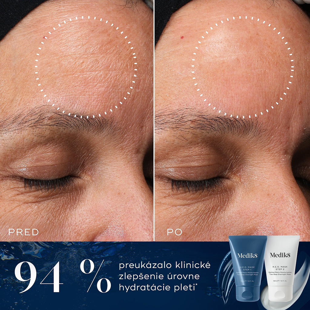 Porovnanie čela účastníka pred a po ošetrení, zobrazené vedľa tubiek Medik8 H.E.O. Mask Step 1 a Step 2. Na obrázkoch je viditeľné zníženie jemných vrások a hladšia textúra pleti. Text zdôrazňuje, že u 94 % účastníkov došlo k klinickému zlepšeniu úrovne hydratácie pokožky.