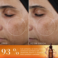 Super C Ferulic™