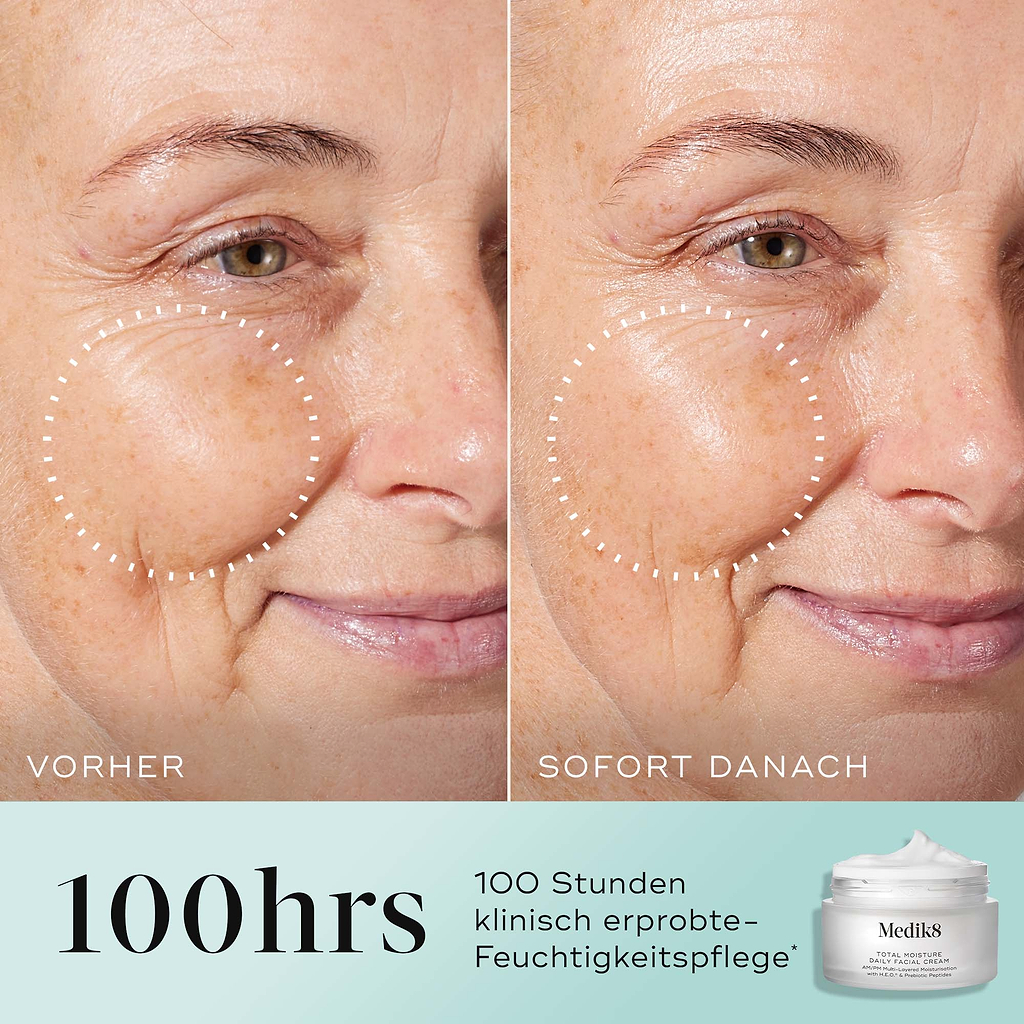 Denný krém na tvár Total Moisture Daily Facial Cream™ (cestovná veľkosť)
