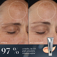 97 % – Porovnanie pred a po na čele účastníka ukazuje viditeľné zlepšenie pleti po jednom balení Medik8 Crystal Retinal. Text uvádza, že 97 % ľudí malo pocit, že ich pleť pôsobí mladistvejšie.

9/10 – Porovnanie pred a po na čele osoby ukazuje viditeľné zlepšenie jemných liniek a vrások po jednom balení Crystal Retinal. Text uvádza, že 9 z 10 súhlasí, že ide o najlepší anti-ageing sérum, aké kedy použili.

