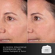 Porovnanie tváre účastníčky pred a po 28 dňoch, zobrazené vedľa balenia krému Medik8 Advanced Pro-Collagen+ Peptide Cream. Text zdôrazňuje klinicky preukázané výsledky v oblasti hladkosti, pevnosti a štruktúry pokožky.