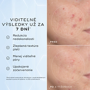 Porovnanie detailných záberov na líce pred aplikáciou a po 4 týždňoch zobrazuje viditeľné zmiernenie začervenania a nedokonalostí textúry, čo dopĺňa text pod nimi s informáciou, že produkt je klinicky overený na redukciu viditeľného začervenania a zlepšenie zdravia kožnej bariéry.
