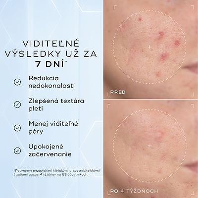 Porovnanie detailných záberov na líce pred aplikáciou a po 4 týždňoch zobrazuje viditeľné zmiernenie začervenania a nedokonalostí textúry, čo dopĺňa text pod nimi s informáciou, že produkt je klinicky overený na redukciu viditeľného začervenania a zlepšenie zdravia kožnej bariéry.