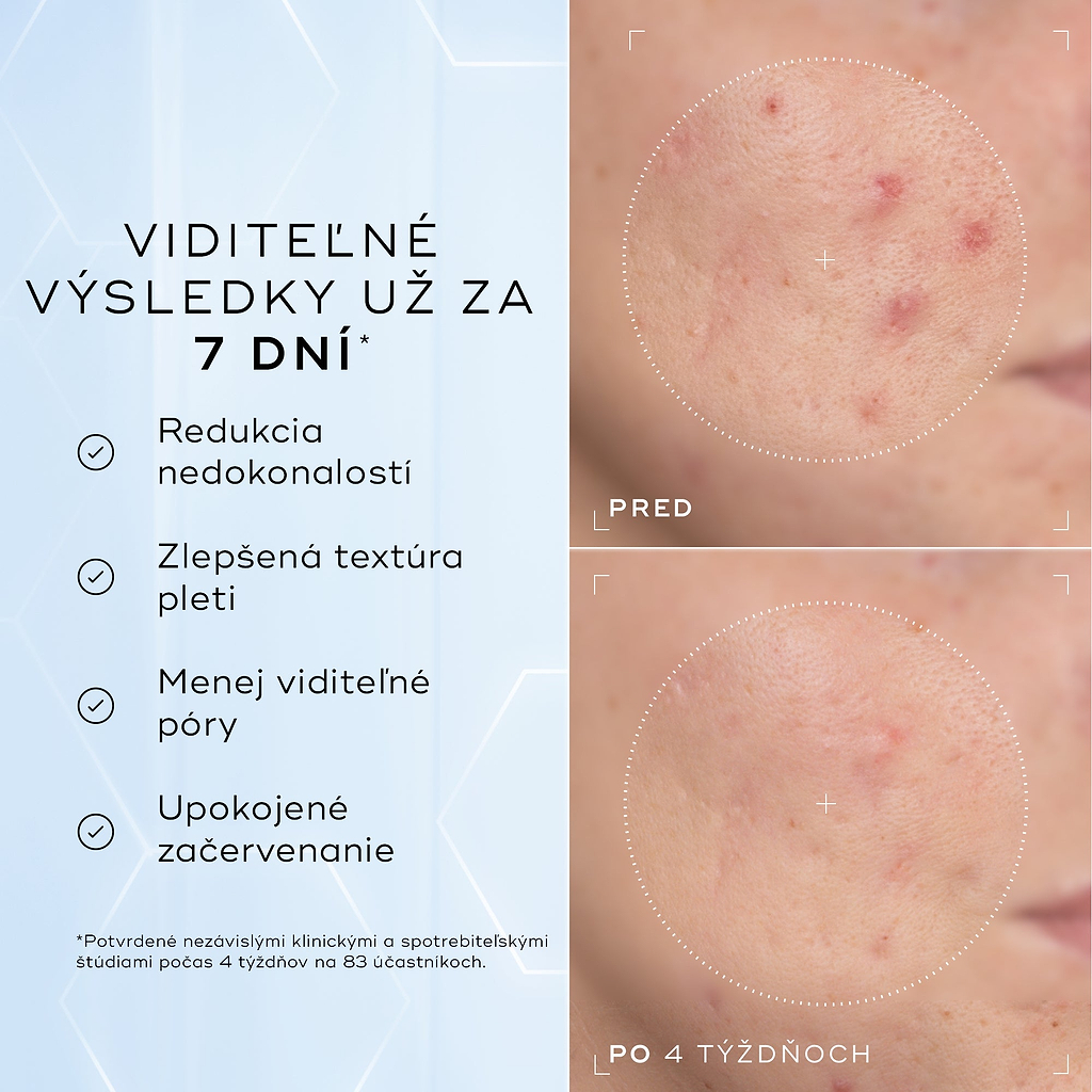 Porovnanie detailných záberov na líce pred aplikáciou a po 4 týždňoch zobrazuje viditeľné zmiernenie začervenania a nedokonalostí textúry, čo dopĺňa text pod nimi s informáciou, že produkt je klinicky overený na redukciu viditeľného začervenania a zlepšenie zdravia kožnej bariéry.