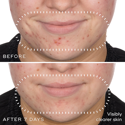 Niacinamide Peptides