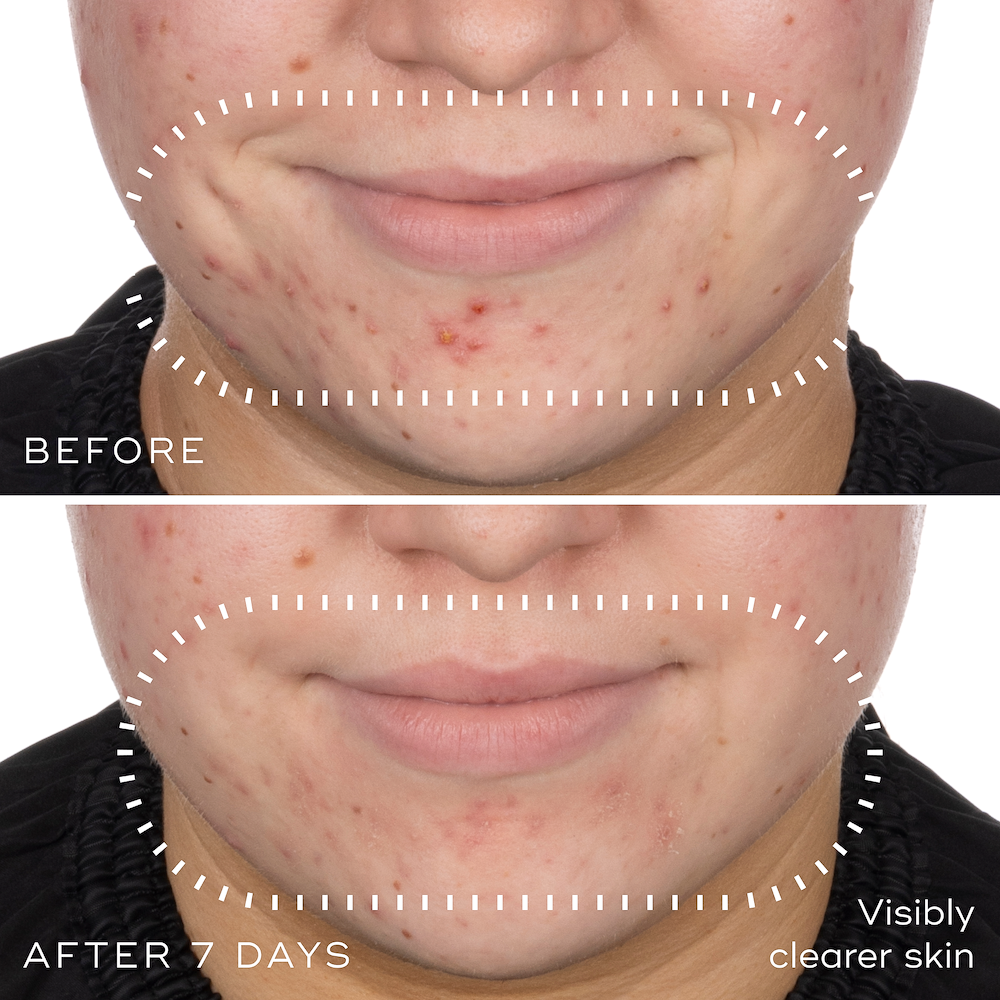 Niacinamide Peptides
