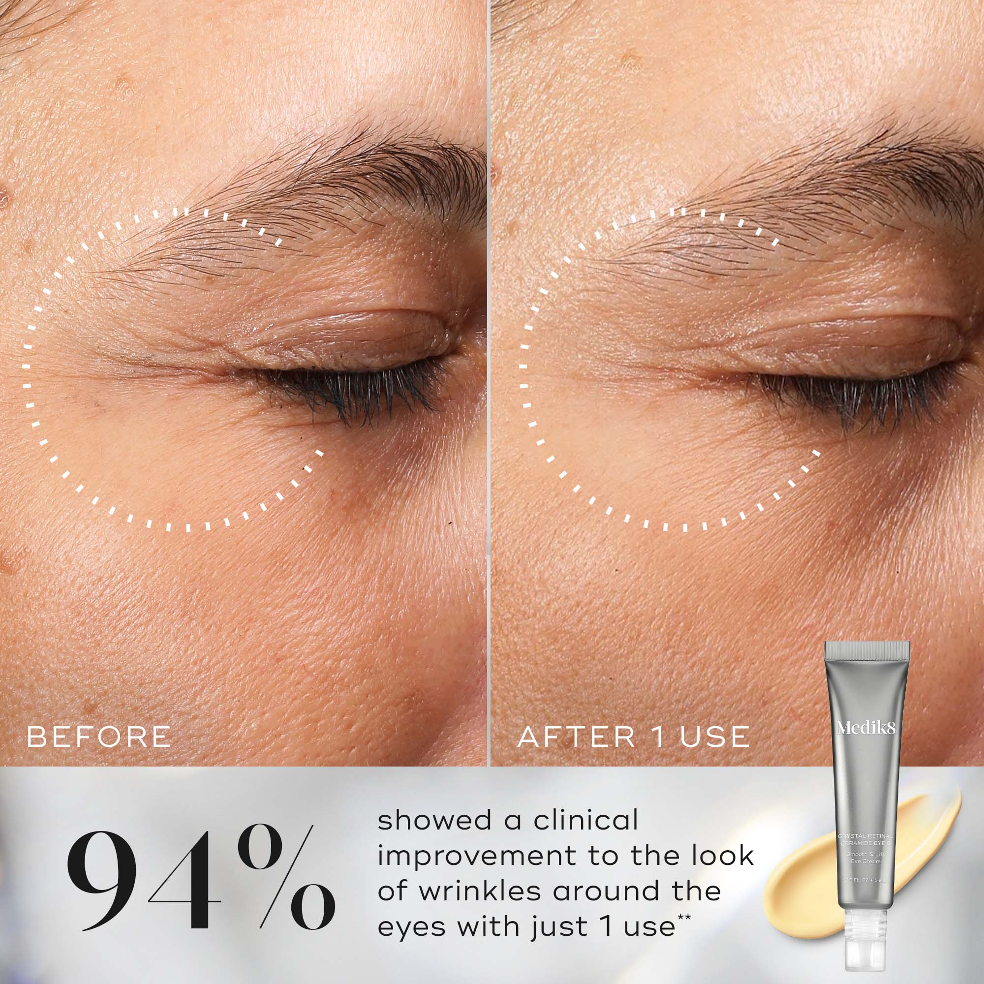 Crystal Retinal Ceramide Eye | Vitamin A Serum – Medik8-US