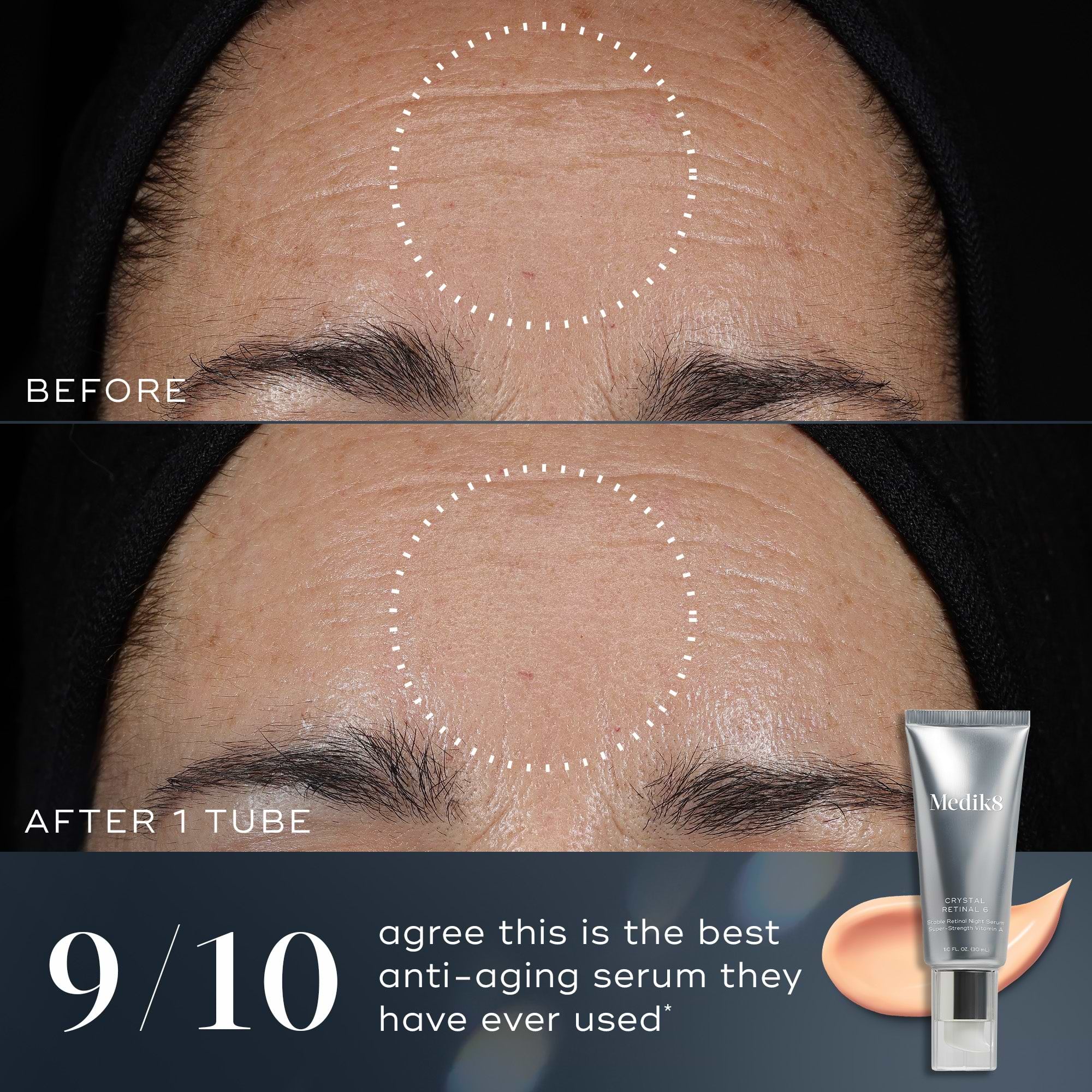 Crystal Retinal for Skin - Retinal Serum – Medik8-US