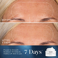 Advanced Night Ceramide