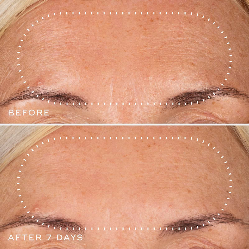 ghk cu before and after Official Medik8 US – Medik8-US