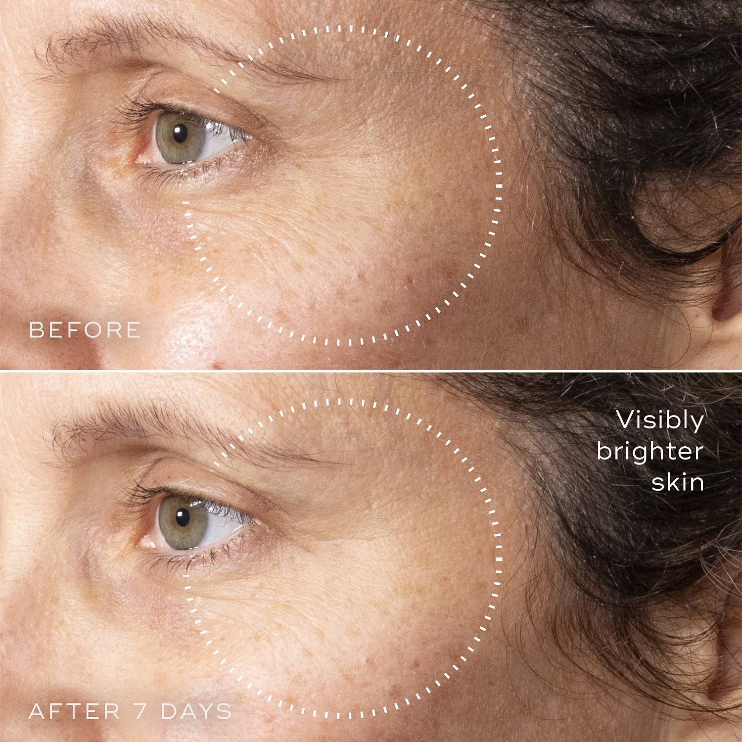 C-Tetra™ Advanced Gel-Serum