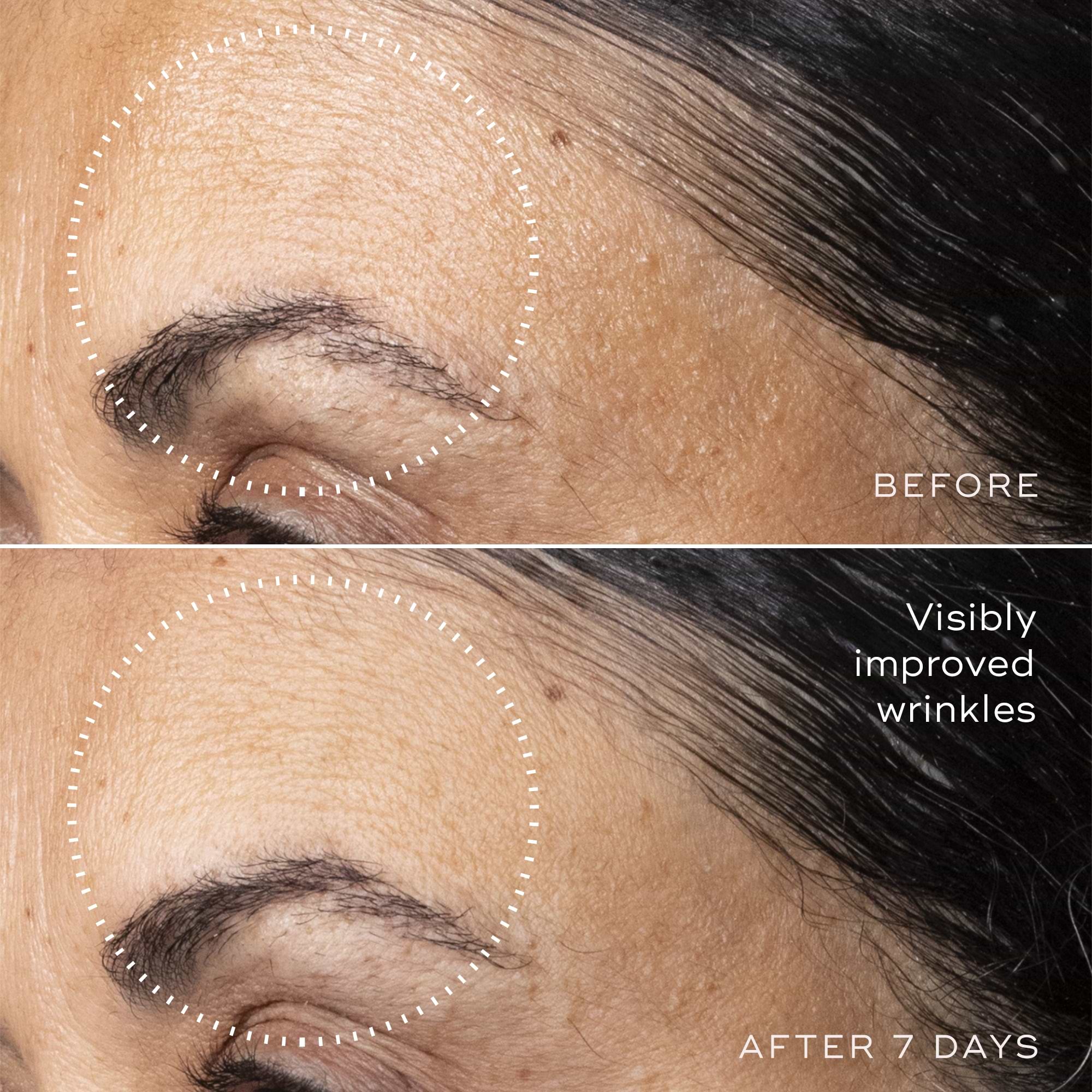 C-Tetra™ Advanced Gel-Serum – Medik8-US